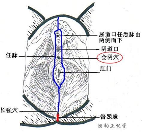 陰阜突出